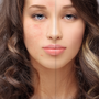 Beautiful Skin Without Chemicals: Natural Remedies for Rosacea