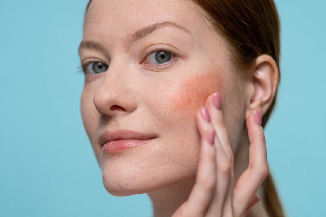 Best Foundation for Redness: How to Get Even Coverage Without Looking Cakey