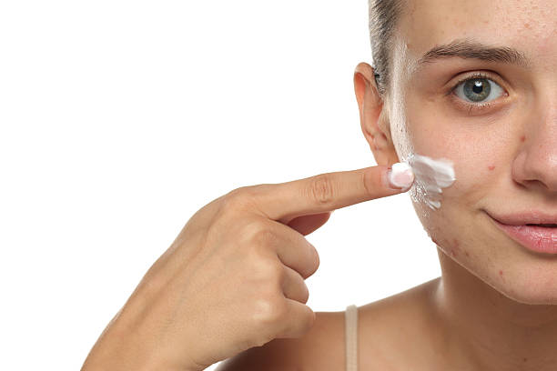 Best Makeup for Acne-Prone Skin: Tips & FAQs